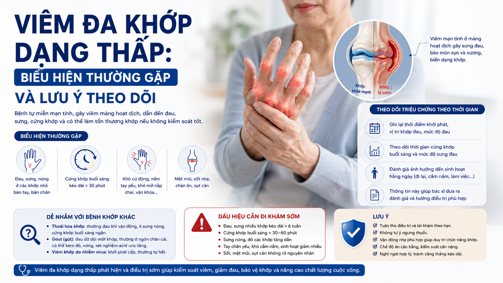 Viêm đa khớp dạng thấp: Biểu hiện thường gặp và lưu ý theo dõi